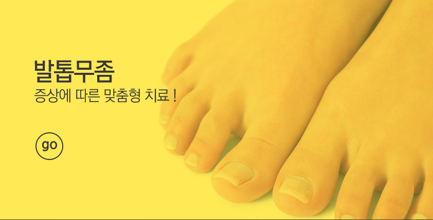 발톱무좀 증상에 따른 맞춤형 치료! go